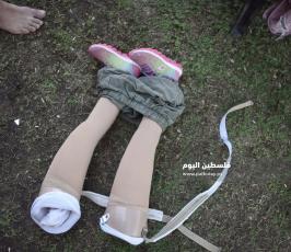 اطفال مبتورين ‫(1)‬ ‫‬.jpg