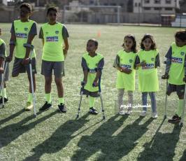 اطفال مبتورين  ‫(178603281)‬ ‫‬.jpg