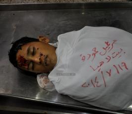  شهداء وجرحى 2014