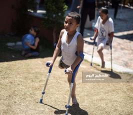 اطفال مبتورين ‫(327589943)‬ ‫‬.jpg
