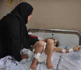عشرات الجرحى من الاطفال
