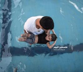 اطفال مبتورين ‫(327589949)‬ ‫‬.jpg