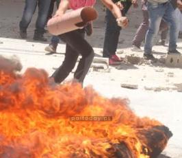 بالصوراصابات في مواجهات مع قوات الاحتلال في كفر عقب شمال القدس المحتلة