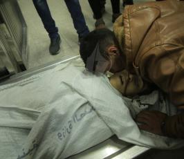 شهيد الفتى محمد الداية في مستشفى الشفاء استشهد متاثرا باصابته شرق غزة ‫(43057666)‬ ‫‬.JPG