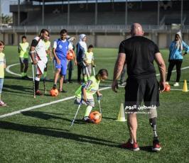 اطفال مبتورين  ‫(178603272)‬ ‫‬.jpg