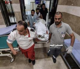 اصابات القصف ‫(311179871)‬ ‫‬.jpg