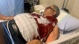 الزميل الصحفي المصاب علي سمودي يروي تفاصيل استشهاد أبو عاقلة