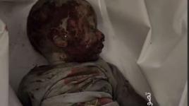 وصول الطفل منصور البيوك وأشلاء من قصف حي المنارة إلى مجمع ناصر