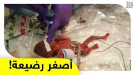 ولدت بوزن 245 جراما.. كيف تشبثت أصغر رضيعة في العالم بالحياة؟ - - -
