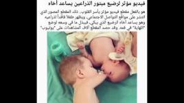 فيديو  مؤثر  لرضيع  مبتور  الذراعين  يساعد اخاه