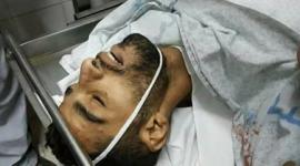 اسعاف