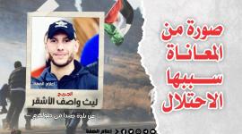 الجريح الأشقر .. صورة من المعاناة سببها الاحتلال