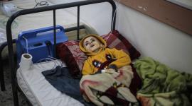 طفل في غزة يعاني من سوء تغذية حاد