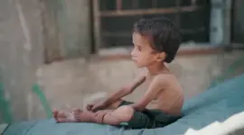 تجويع غزة