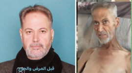 استشهاد الكاتب الدكتور عمر حرب بسبب سوء التغذية في غزة