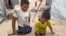 طفلان غزيان مبتورا الأطراف جراء استهدافهما بالصواريخ الإسرائيلية خلال حرب الإبادة