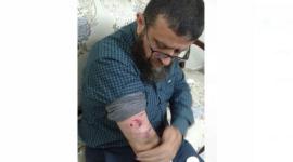 الشيخ خضر عدنان اصيب بقنبلة غاز.JPG