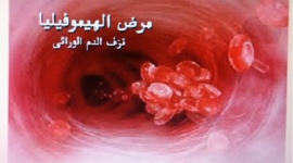 مرض