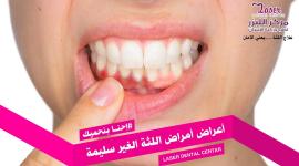 مركز الليزر