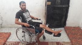 صورة ارشيفية للجريح
