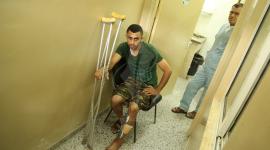 مصابين مسيرة العودة داخل قسم قسم الأشعة ‫(42336770)‬ ‫‬.JPG