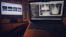 برنامج لتشخيص فيروس كورونا