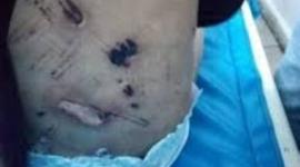 حقيقة تعذيب الطفلة جنى من قبل جدتها