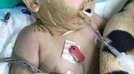 الطفل المصاب بلدغة العقرب