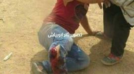 صورة المصاب الجريح