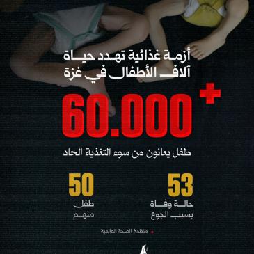 أكثر من 60,000 طفل يعانون من سوء التغذية الحاد