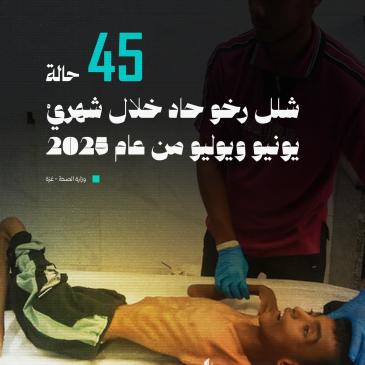 شلل رخو