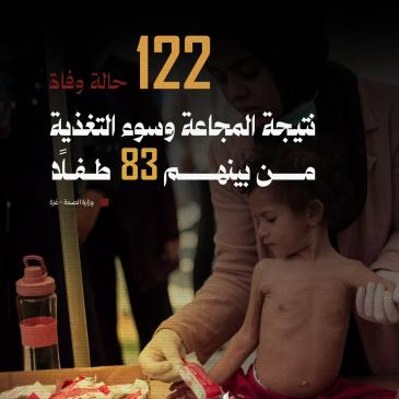وفاء سوؤ تغذية