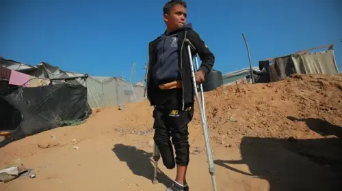 طفل مبتور الساق في غزة