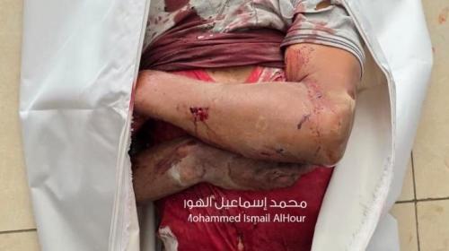 شهيد في غزة (أرشيفية)