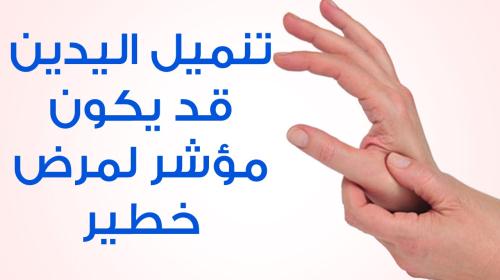 تنميل اليدين