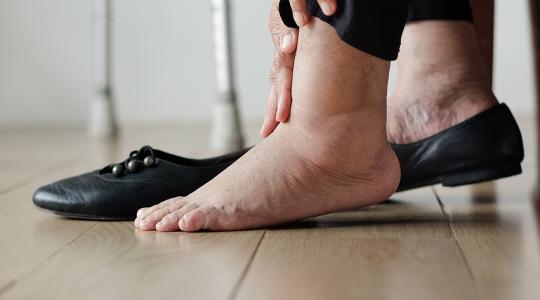 10 أسباب لاحتباس الماء في الجسم.. تعرف عليها