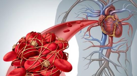 أفضل 5 أطعمة تساعد في تدفق الدورة الدموية