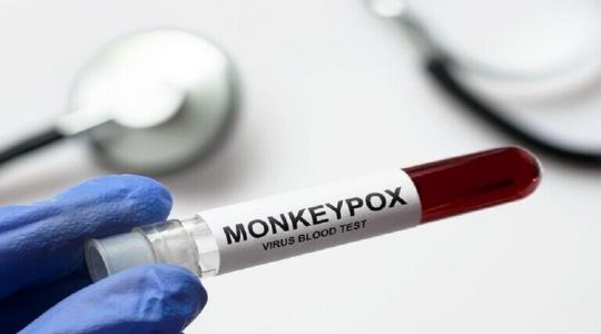 تطعيم جدري القرود.jpg