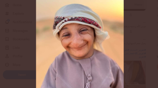 صور.. تفاصيل جديدة سبب وفاة عزيز الأحمد القزم الكوميدي السعودي اليوم - طبيعة المرض