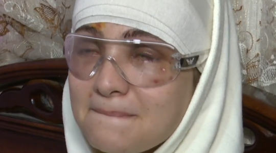 ما قصة البلوجر سارة محمد التي فقدت بصرها- القصة كاملة لإصابة البلوجر سرة محمد بالعمى