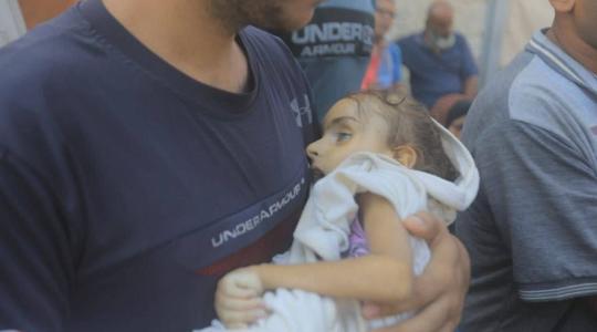 استشهاد طفلة نتيجة سوء التغذية