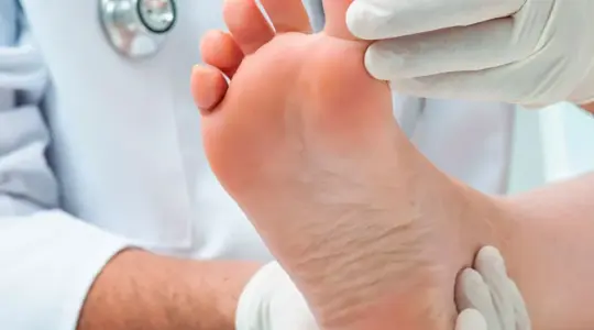 377089-فحص-القدم-السكرى