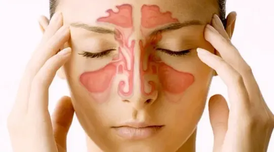 طريقة فعالة لعلاج التهاب الجيوب الأنفية