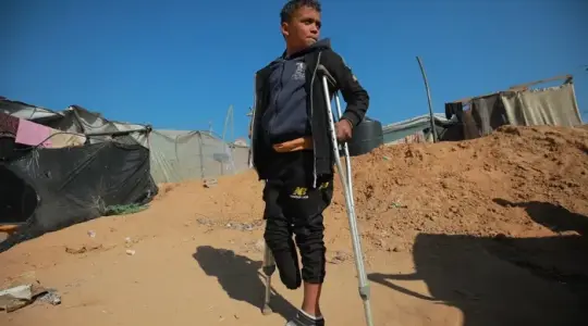 طفل مبتور الساق في غزة