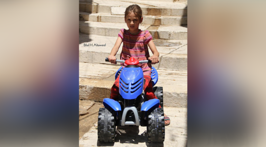 الطفلة أنوار برقان بعد الحادثة تصوير بلال الطويل 