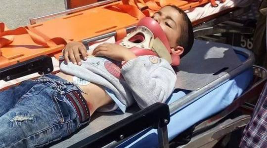 الطفل الذي تعرض للدهس من قبل مستوطن