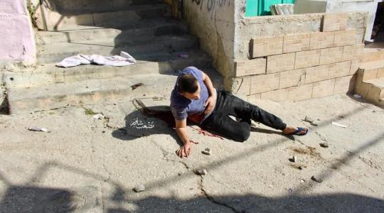 الشهيد هيثم البدوي بعد إطلاق النار عليه