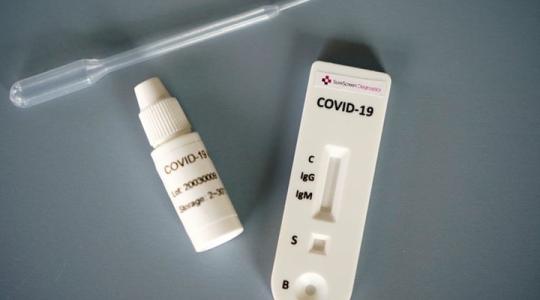 جهاز فحص فيروس كورونا كوفيد -19
