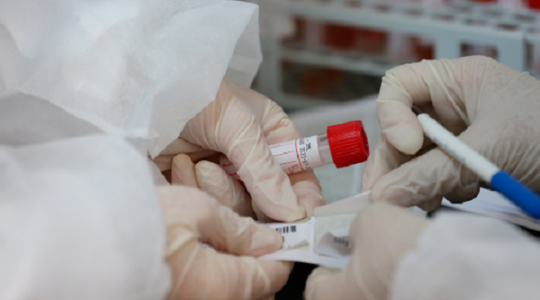 صحة رام الله: توفير مواد فحص فيروس "كورونا" في مختبرات الوزارة
