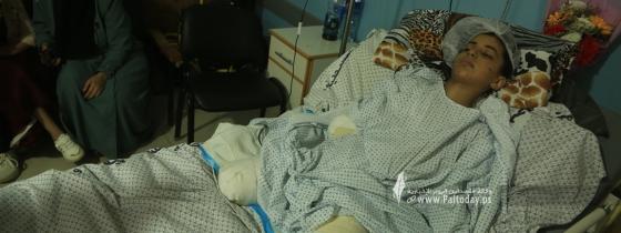 بالصور: رهف سلمان.. طفلة أفقدها العدو "الإسرائيلي" أطرافها الثلاثة في مجزرة جديدة ارتكبها في مخيم جباليا أسفرت عن استشهاد 7 شهداء أطفال و35 جريحًا